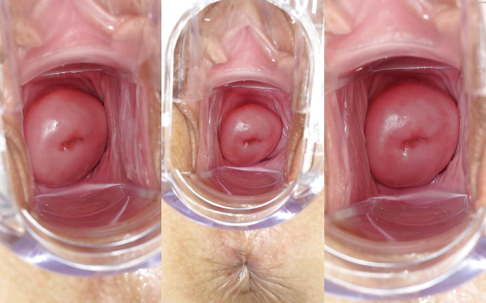 24P Cervix with a Smile!