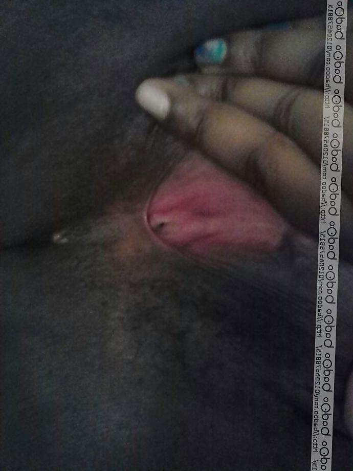7P 22 year old fat bitch