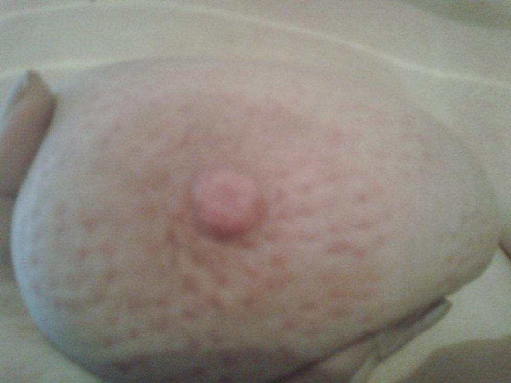 9P Punishment for wearing a brassiere.