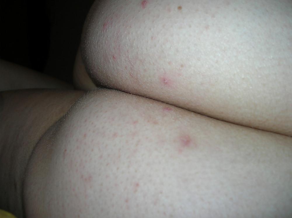 16P FAT HAIRY BITCH FROM GERMANY