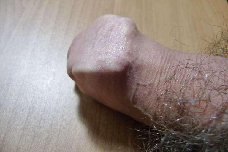 5P Foreskin play with hair clamps (2)