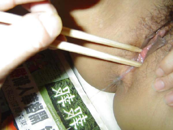 5P Chinese gynecologist