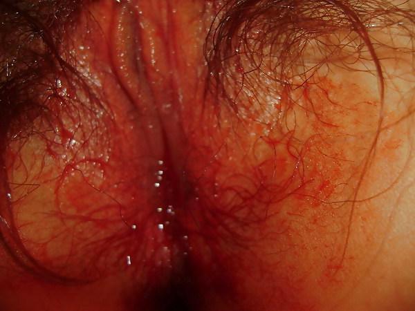 7P Chinese pussy