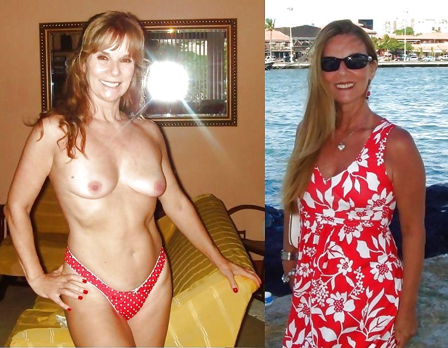 25P Real amateurs dressed an undressed set 2