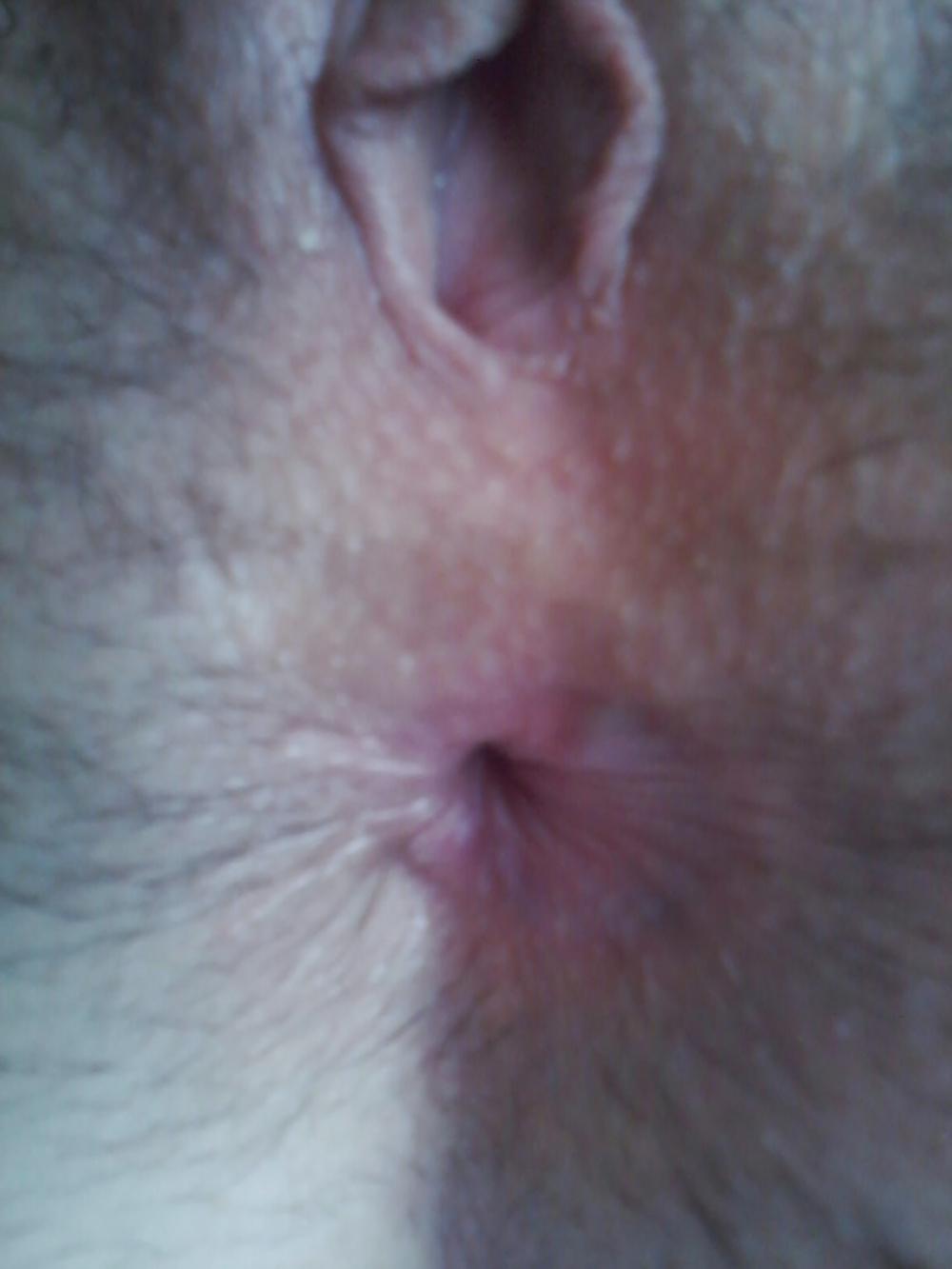 17P Anal play