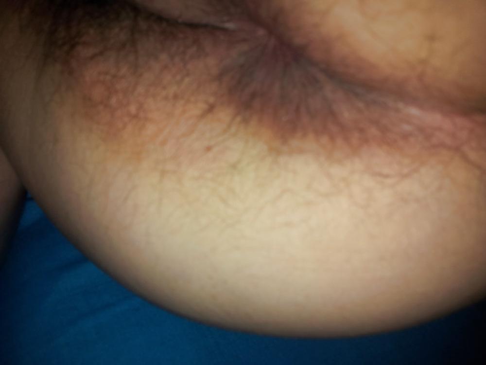 25P Fat bbw wife 