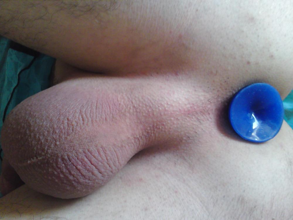 17P Anal play