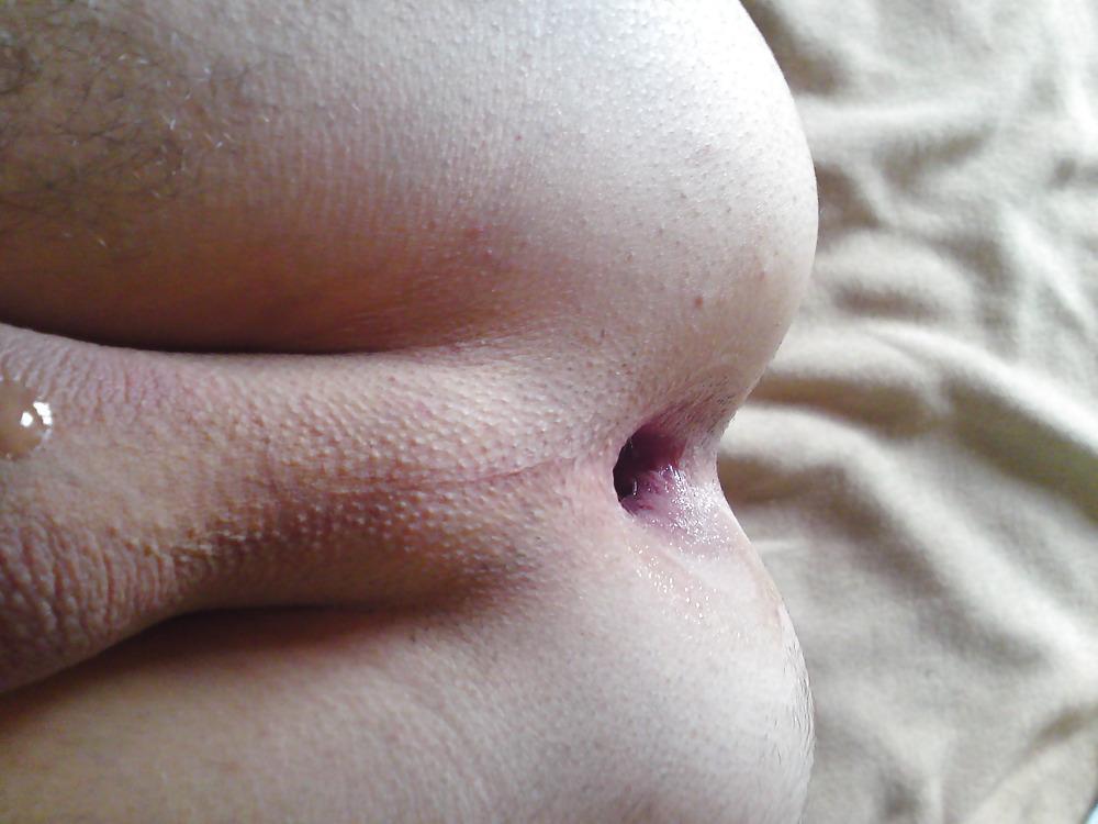 17P Anal play
