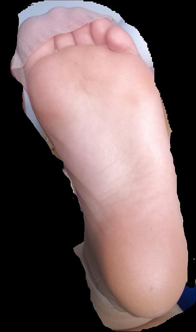 8P Nylon feet and legs