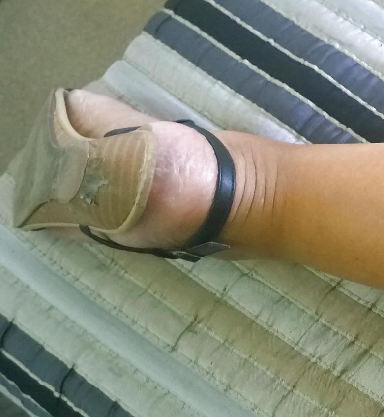 25P Wife Feet and Legs