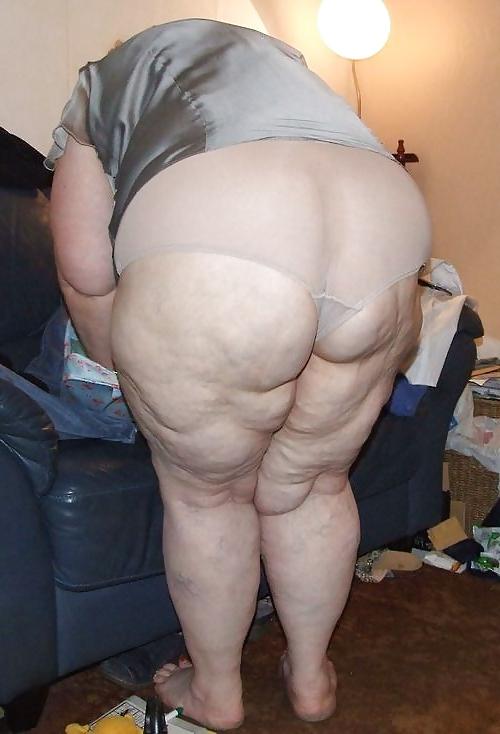 25P I love female adipose tissue part 3