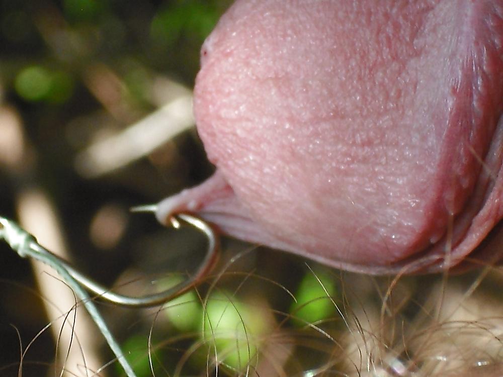 11P FORESKIN PLAY .....