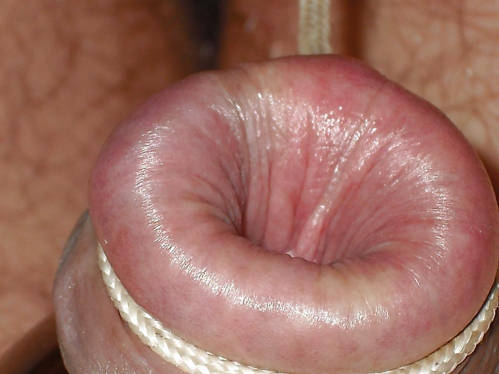 11P FORESKIN PLAY .....