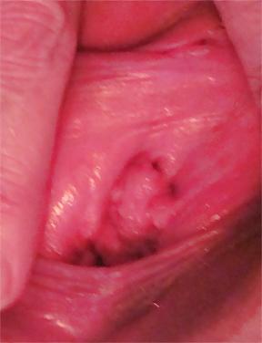 25P Pussy Close-Ups