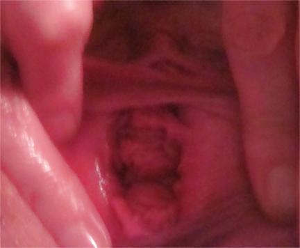 25P Pussy Close-Ups