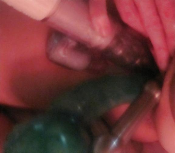 25P Pussy Close-Ups