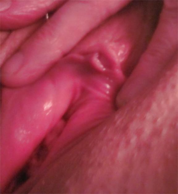 25P Pussy Close-Ups
