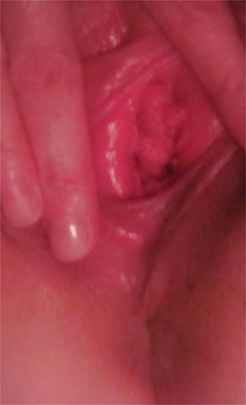 25P Pussy Close-Ups