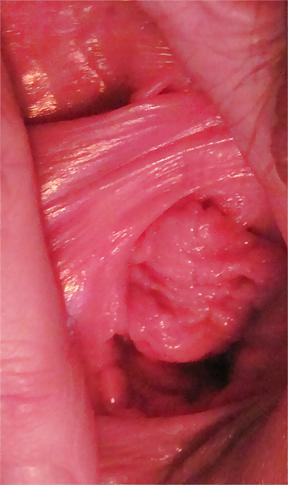 25P Pussy Close-Ups