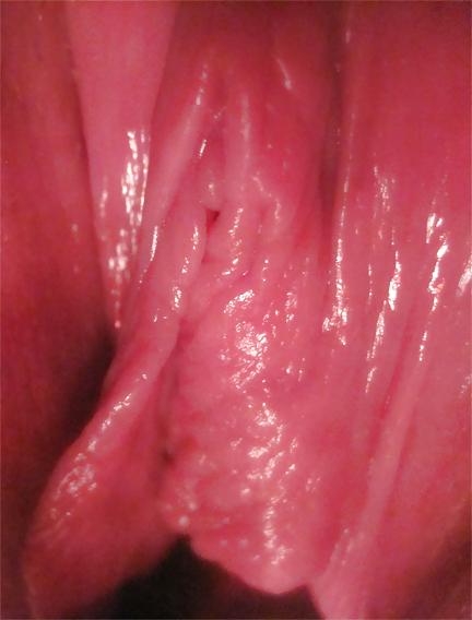 25P Pussy Close-Ups