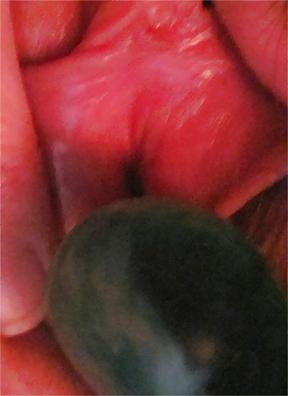 25P Pussy Close-Ups
