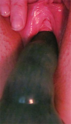 25P Pussy Close-Ups