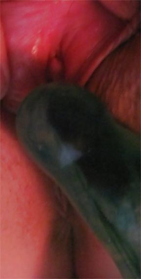 25P Pussy Close-Ups