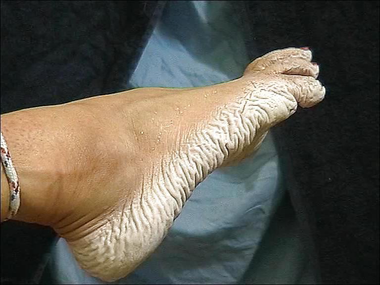 21P Bianca's wet wrinkled feet 