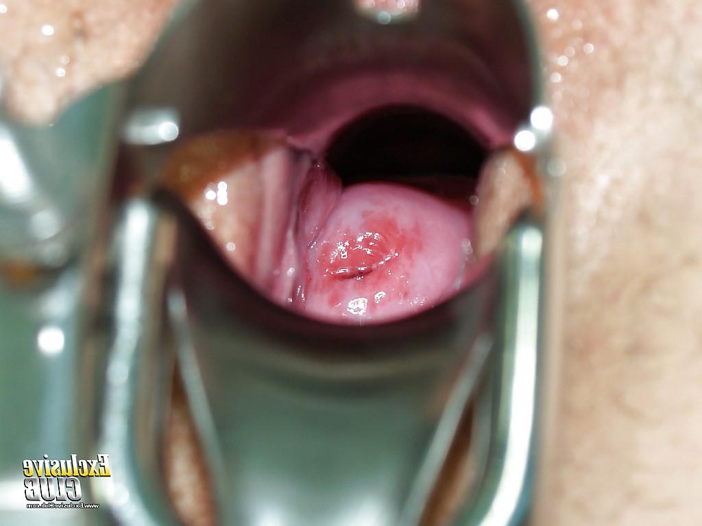 13P Cute skinny babe Jane undressing for a gyno exam of her pussy