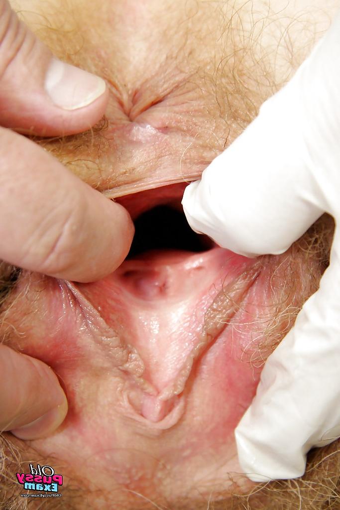 16P Mature brunette gets her hairy twat examed and toyed by gyno