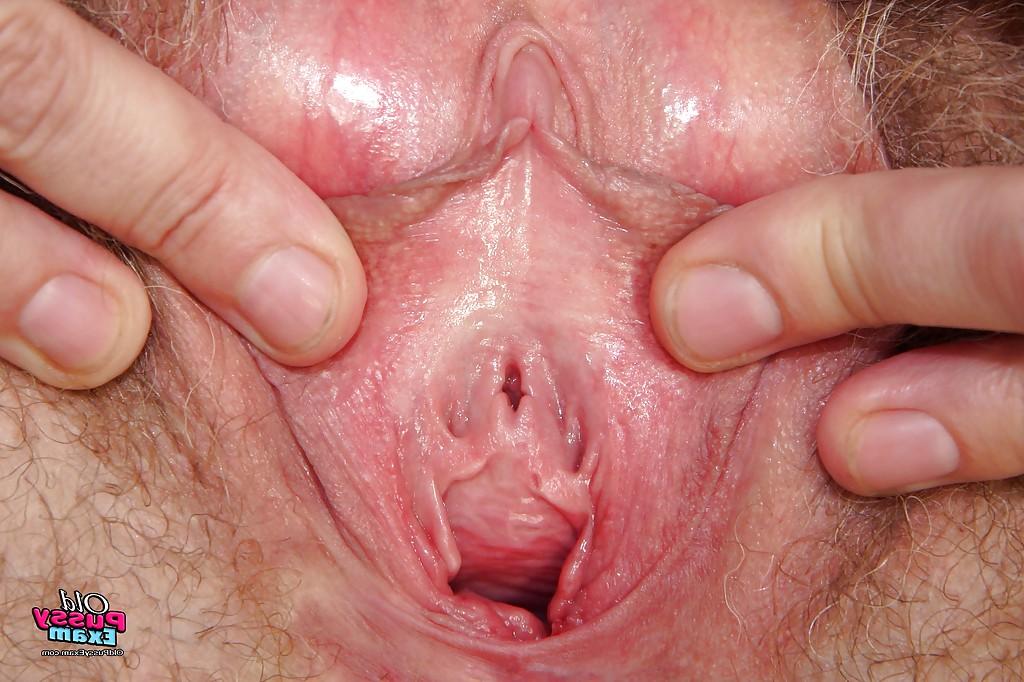16P Mature gyno nurse in stockings stuffing her unshaven twat with a speculum