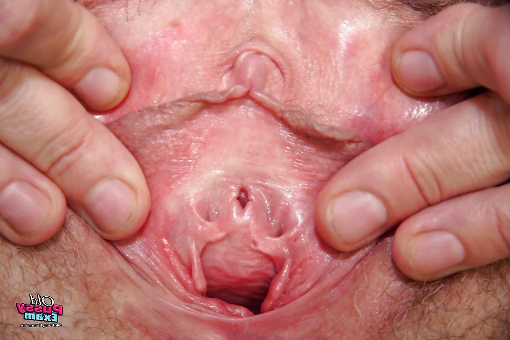 16P Mature gyno nurse in stockings stuffing her unshaven twat with a speculum