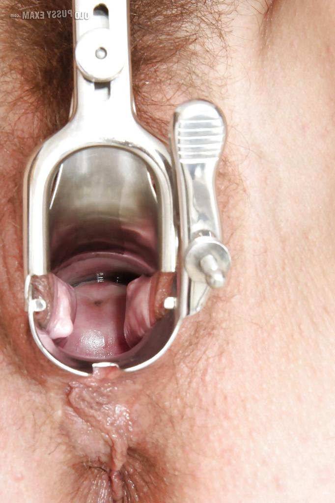 16P Stunning mature lady in glasses gets her bushy twat examed by gyno
