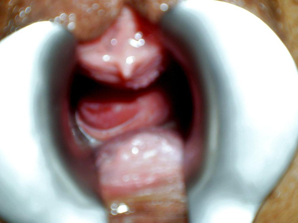 16P My GF play with her pussy 