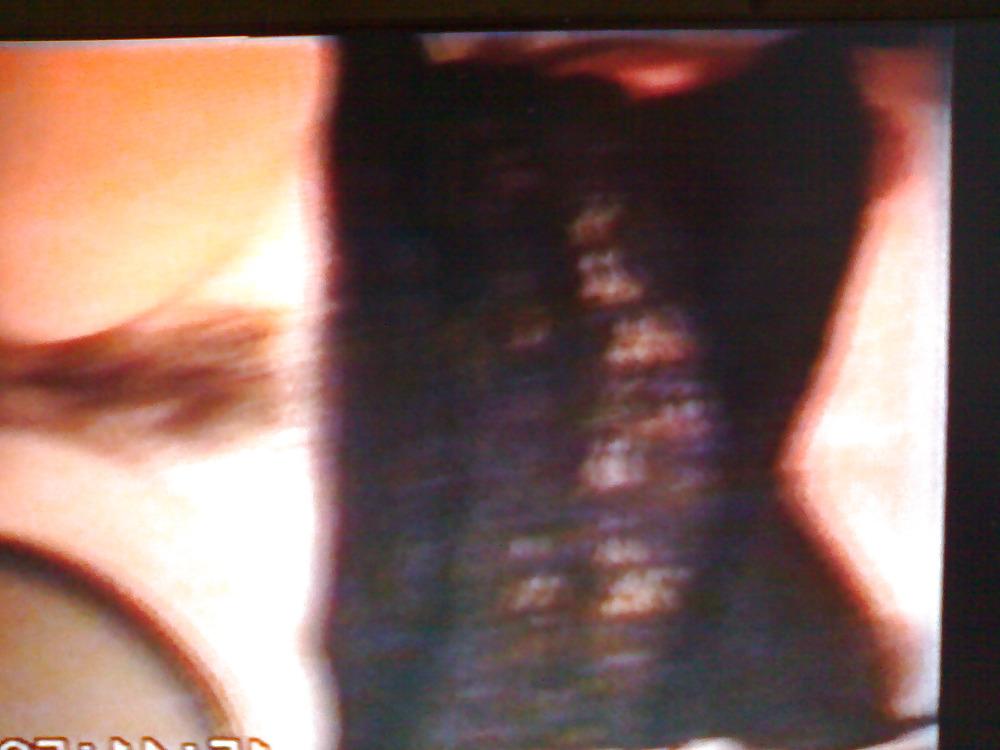 25P Michelle - Some artistic shots!!!