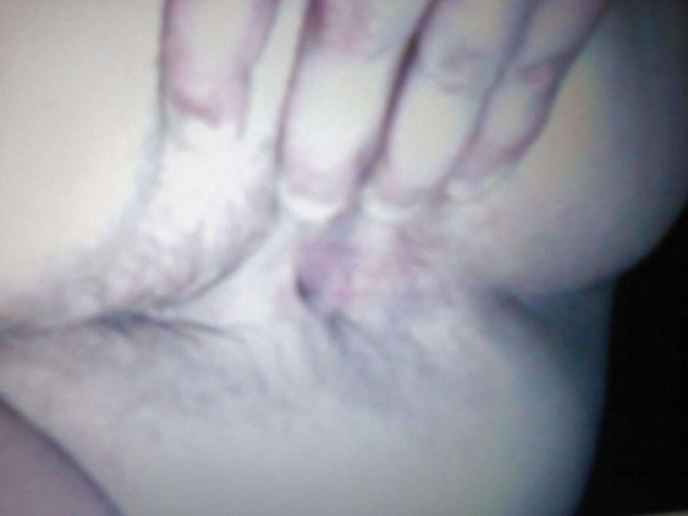 14P Me and my fat body