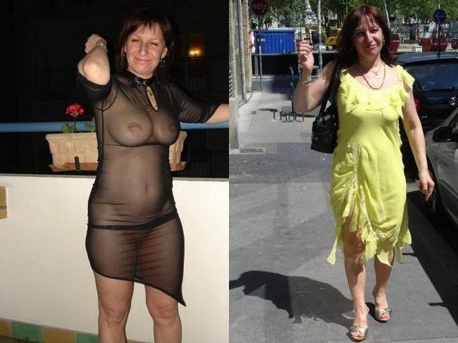 20P Beforeafter nudes of real women