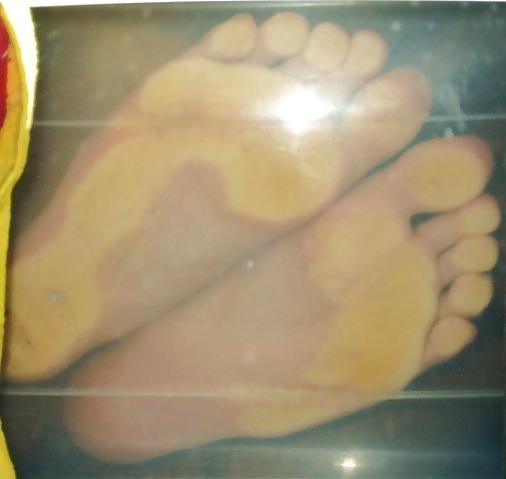 14P Nylon corap feet