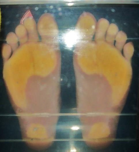 14P Nylon corap feet