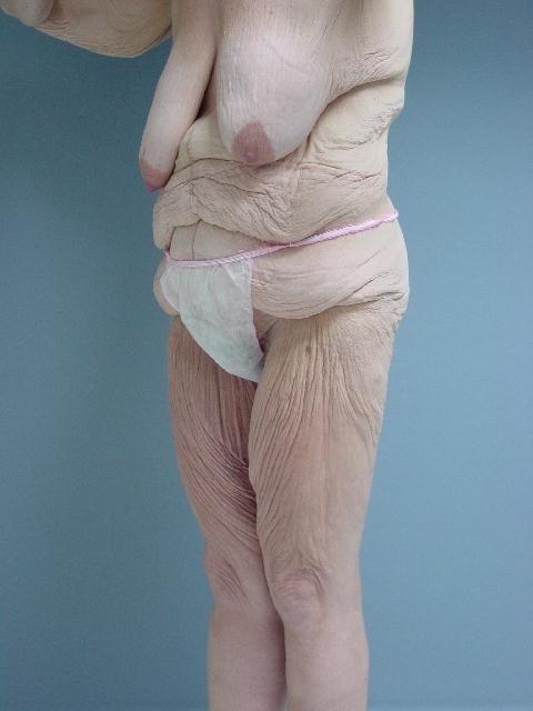 15P Older Grannies and matures showing their wrinkled bodies