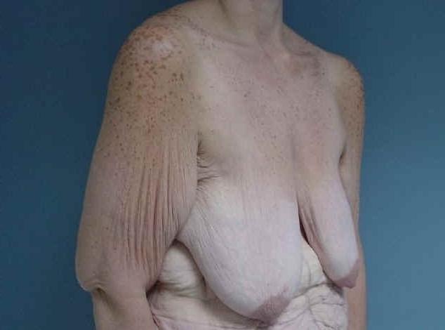 15P Older Grannies and matures showing their wrinkled bodies