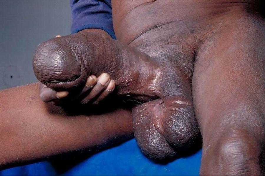 15P monster amateur cocks