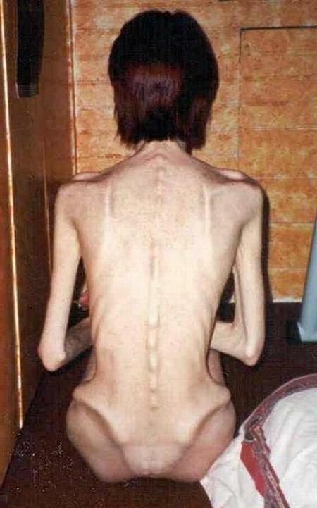 16P Very skinny amateur girls poser