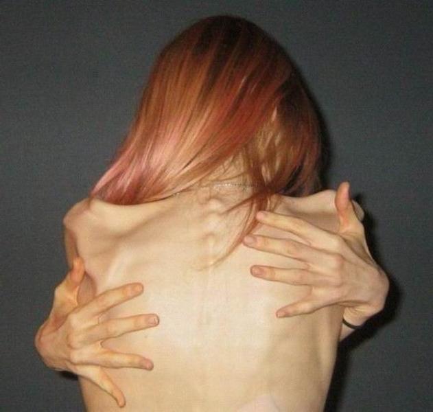 16P extremely skinny amateur girls poser