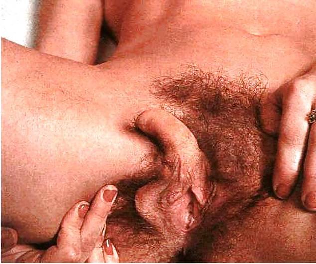 9P Real Hermaphrodites