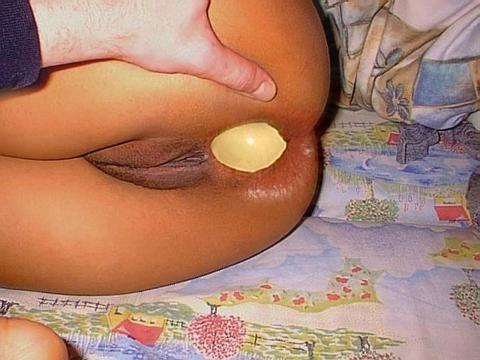 16P extreme anal insertions