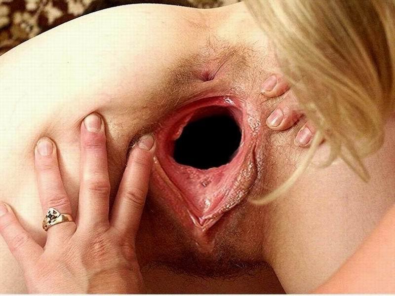 16P extremely gaping holes