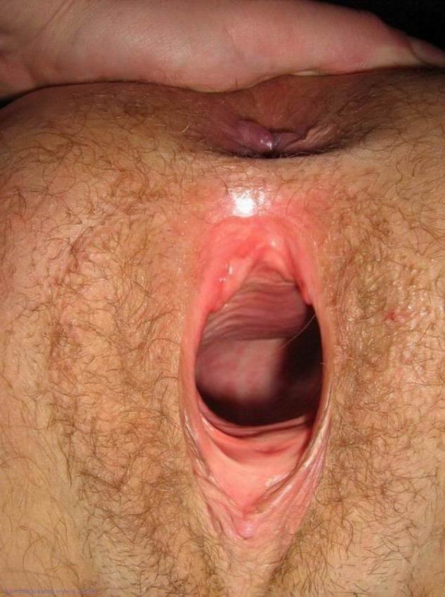 16P extremely gaping holes