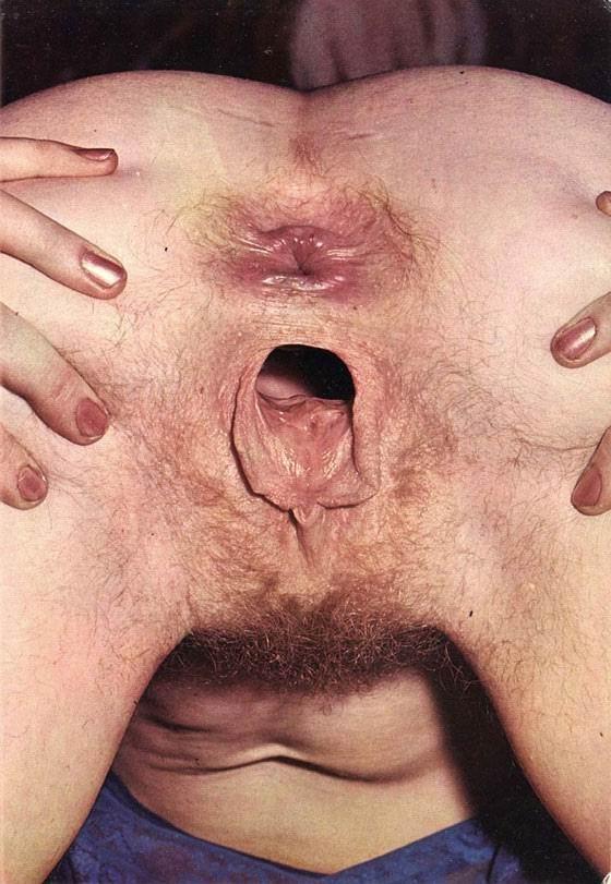 16P extremely gaping holes