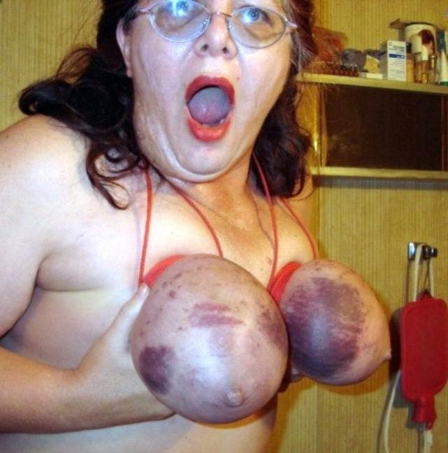 16P extremely bondaged boobs and pussies